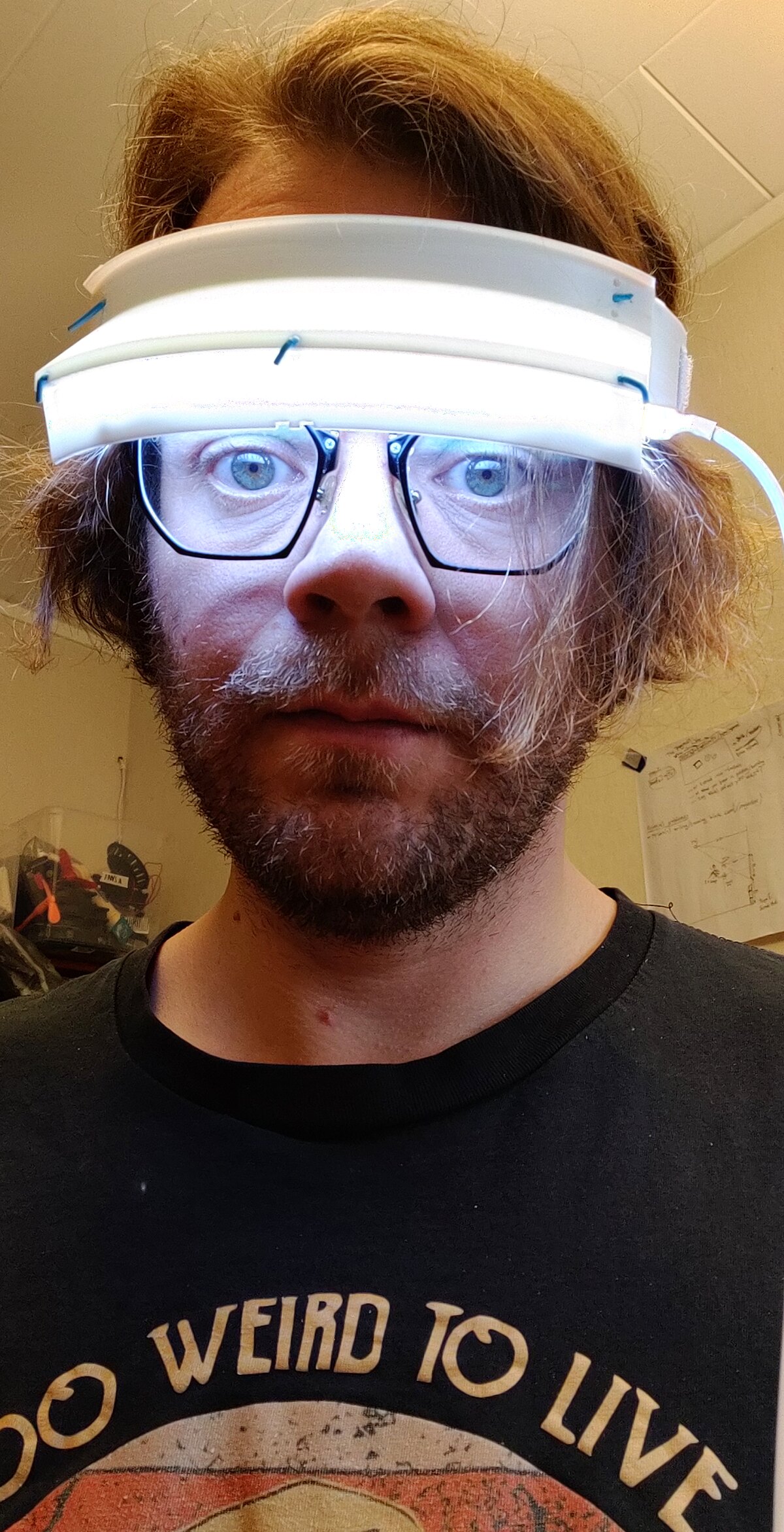 Karl wearing the first Circadius prototype: a white 3D-printed visor across the forehead, glowing softly, held together with blue filament pins